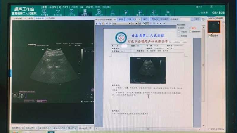 糖尿病居家慢病管理：如何构建个性化方案**